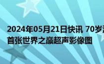 2024年05月21日快讯 70岁汪建第二次登顶珠峰，华大完成首张世界之巅超声影像图