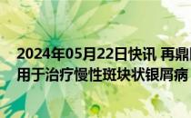 2024年05月22日快讯 再鼎医药：ZL1102尚未在国内获批用于治疗慢性斑块状银屑病