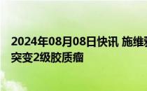 2024年08月08日快讯 施维雅沃拉西德尼在美获批治疗IDH突变2级胶质瘤