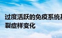 过度活跃的免疫系统基因导致小鼠出现精神分裂症样变化