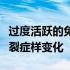 过度活跃的免疫系统基因导致小鼠出现精神分裂症样变化