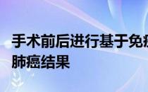 手术前后进行基于免疫疗法的治疗可显着改善肺癌结果